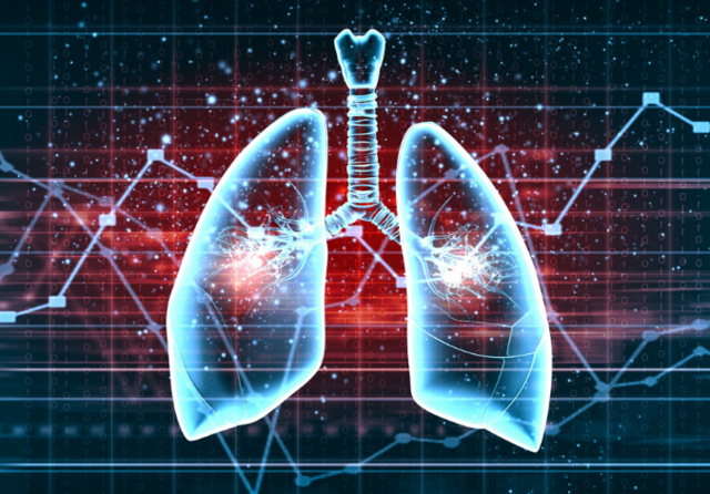 早期肺癌即将迎来全面微创治疗3.0时代